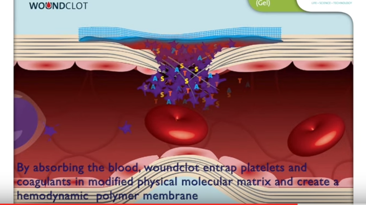 CGI rendition from CSC video showing the Woundclot bandage forming a clot