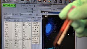 UK anti-doping body faces inquiry over doctor investigation