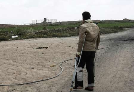 SAID KHATIB (AFP) Tamer Abu Daqqa stands with crutches along the Gaza-Israel border near Khan Yunis in the southern Gaza Strip on April 11, 2018 ( SAID KHATIB (AFP) )