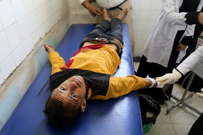 i24NEWS - UN says 11 million children in Yemen 'desperately' need aid