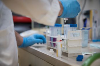 A researcher takes samples for testing at the VIAQUA Therapeutics lab at the Technion-Israel Institute of Technology, in the northern Israeli city of Haifa, on February 19, 2019.