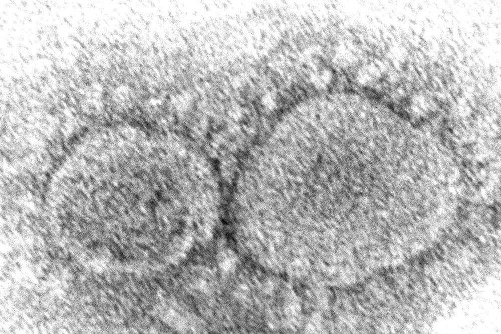 This 2020 electron microscope image made available by the Centers for Disease Control and Prevention shows SARS-CoV-2 virus particles which cause Covid-19.