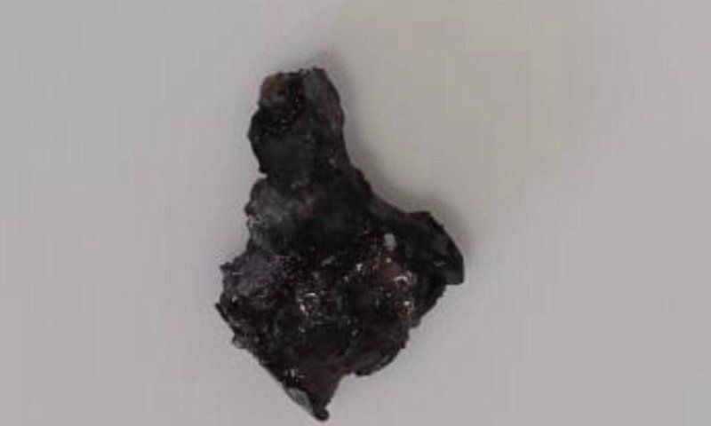 Smotrich publie un message pour Pessah avec la photo de l'éclat d'obus de mortier qui a blessé son fils au Liban