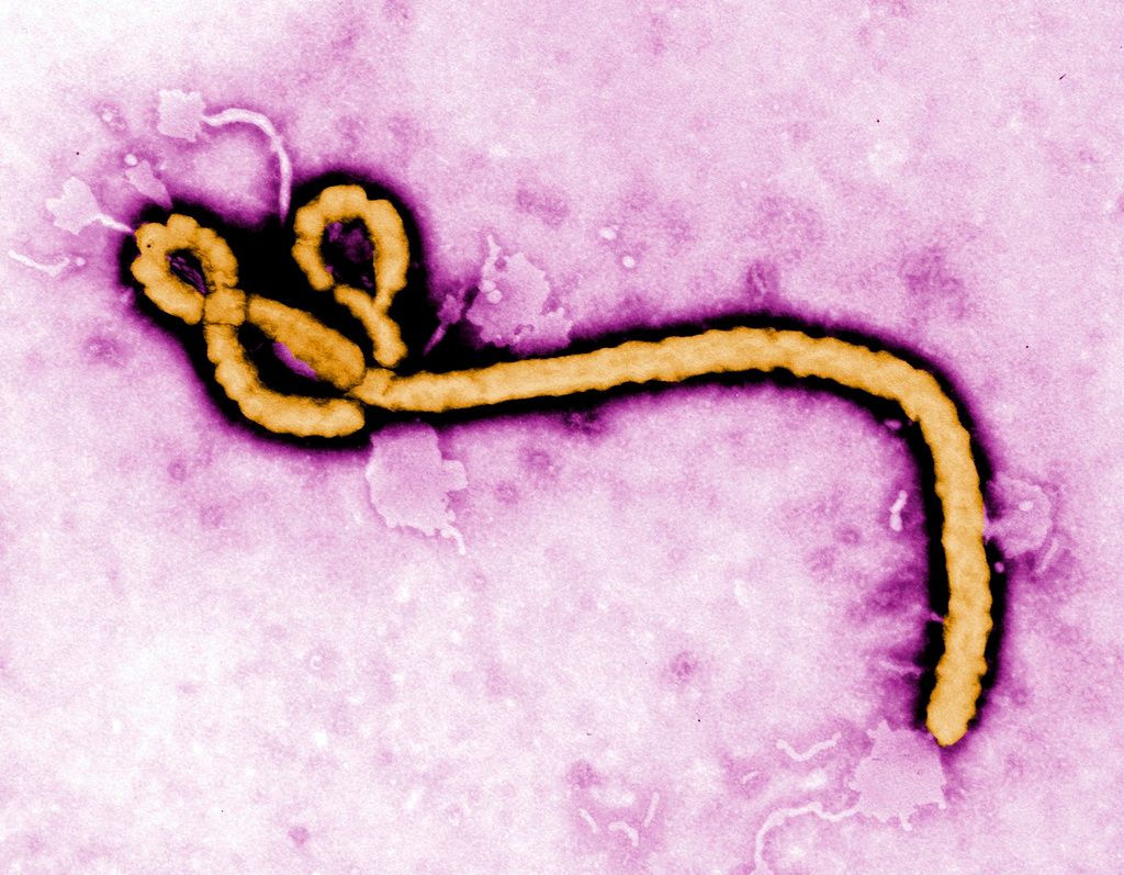 Israel reports second suspected Ebola case in traveler from Congo – i24NEWS