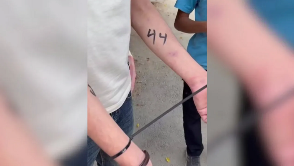 Palestinian with the number 44 drawn on his arm by IDF soldiers operating in the West Bank, August 18, 2026.