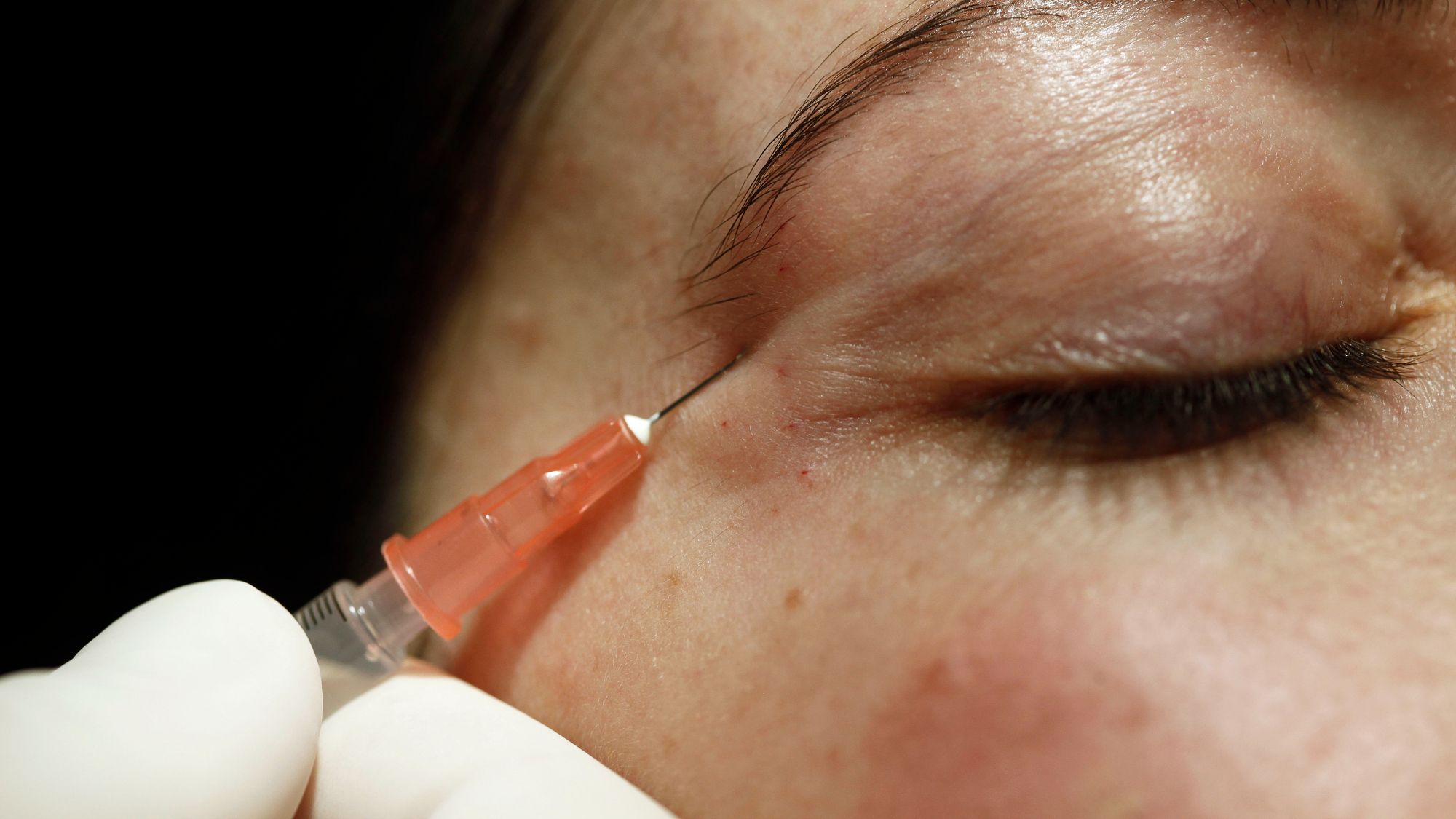 علاج التجميل يتحول إلى مأساة.. وفاة شابة بعد إجراء لمكافحة الشيخوخة في نيويورك