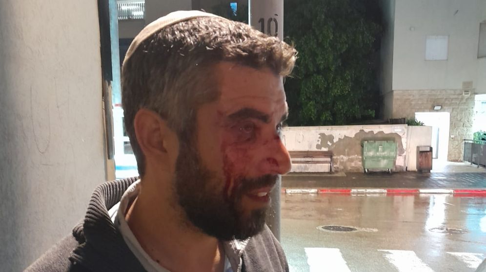 רב בישיבת הסדר הותקף ביפו