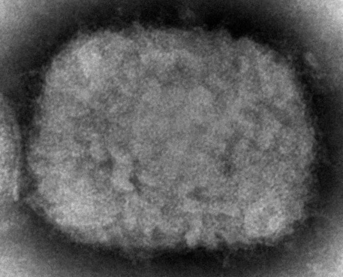 A cepa de Monkeypox causando surto tem mais mutações do que o esperado (estudo)