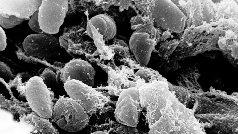 ויקיפדיה צילום מיקרוסקופי של חיידק Yersinia pestis הגורם למחלת הדבר