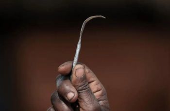 Interdites au Royaume-Uni depuis 1985, les mutilations génitales féminines restent largement pratiquées dans certaines régions du monde.
