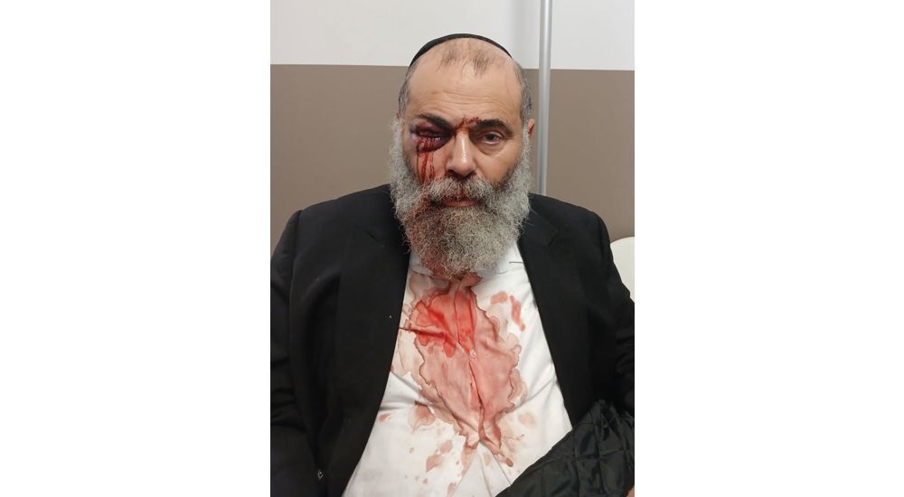 Île-de-France : un fidèle juif agressé en sortant du mikvé témoigne sur i24NEWS