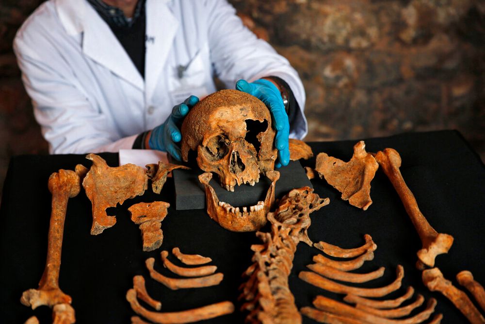 A skeleton suspected to come from a cemetery for victims of the Black Death bubonic plague, in London, the United Kingdom, on March 26, 2014.
