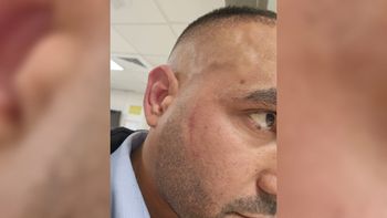 נהג אוטובוס הותקף בעפולה