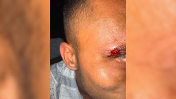 אחד הישראלים שהותקף בקוסמוי