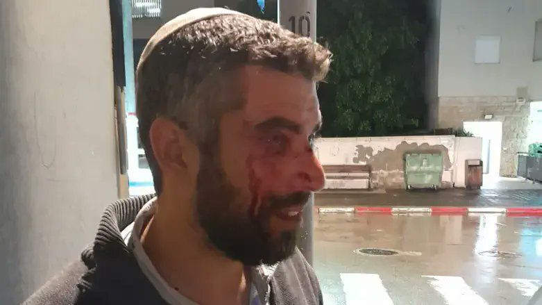 Un rabbin agressé en pleine rue dans le quartier de Jaffa à Tel Aviv, le Shin Bet associé à l’enquête
