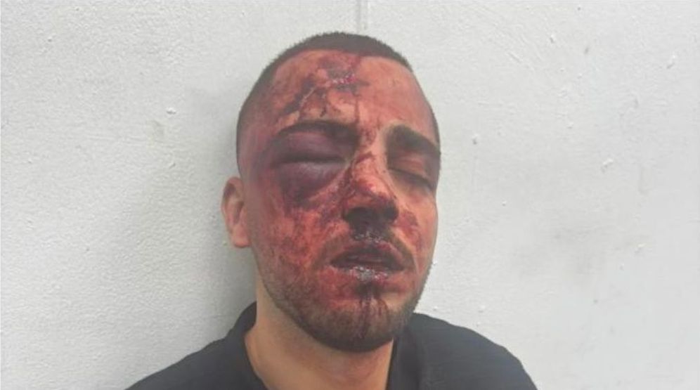 Le procureur du parquet du district sud qui aurait été agressé par des policiers à Beer Sheva le 3 mai 2026. 