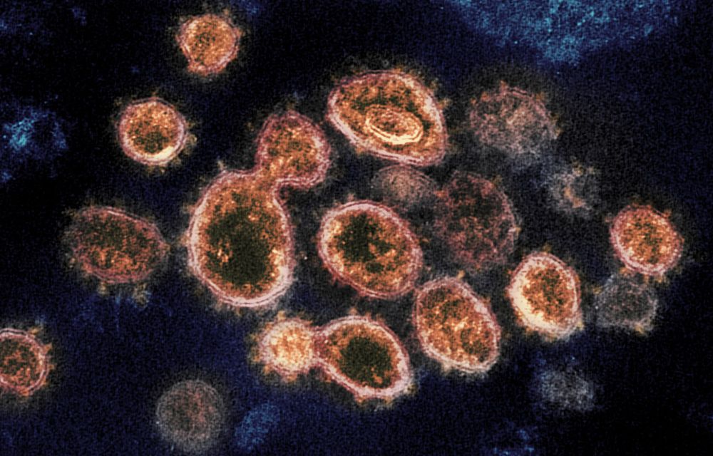 Image au microscope montrant des particules du SARS-CoV-2 à l'origine de la maladie Covid-19