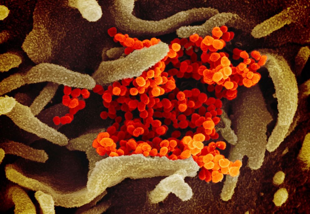 Novel Coronavirus SARS-CoV-2, orange, emerging from the surface of cells, green, cultured in the lab, as seen via electron microscope. Undated.