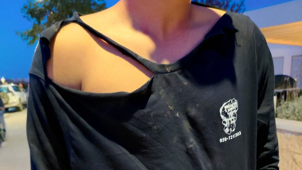 ללא אחד הנערים מהיישוב רתמים שהותקף